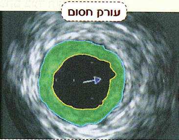 (בספר תמונה:) מודדים קצב לב בעזרת חיישן.